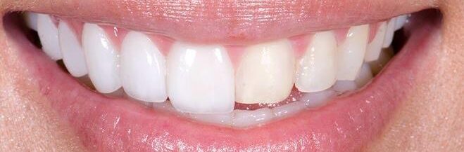 whatsapp image 2026 04 04 at 11.19.30 pm (1)